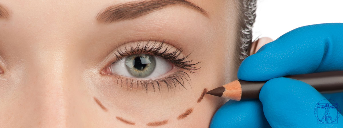 blepharoplastie