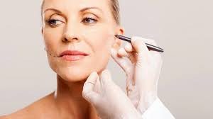 lifting-visage